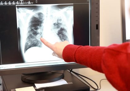 Bij- en nascholing KNCV Tuberculosefonds